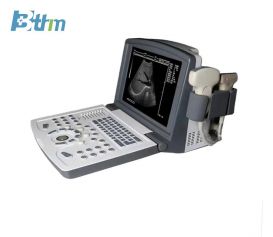 BT-UD1 Ultrasound Scanner with Trolley