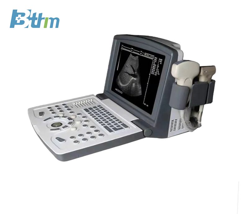 BT-UD1 Ultrasound Scanner with Trolley Wholesale