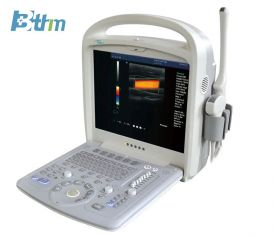 BT-UD3 Color Portable Ultrasound Scanner