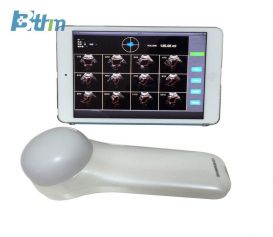 BT-UD5 Wireless 4D Ultrasound Bladder Scanner